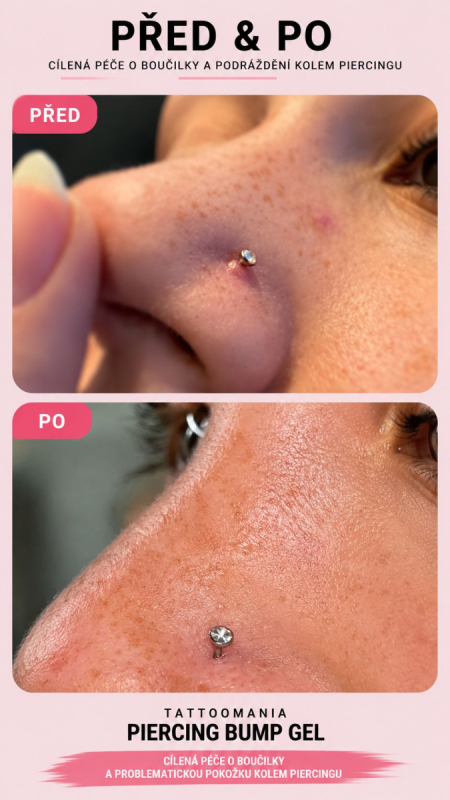 Piercing Bump Gel - Imagen 2