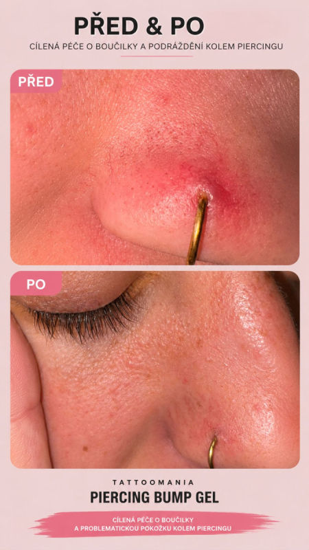 Piercing Bump Gel - Imagen 3