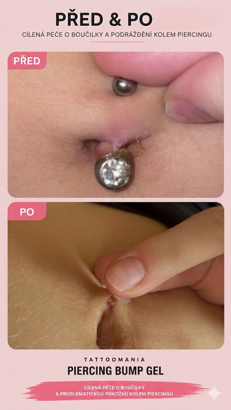Piercing Bump Gel - Imagen 4